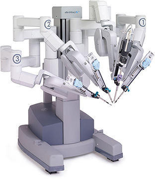 DaVinci Surgical Robot for Aortic Valve Replacement