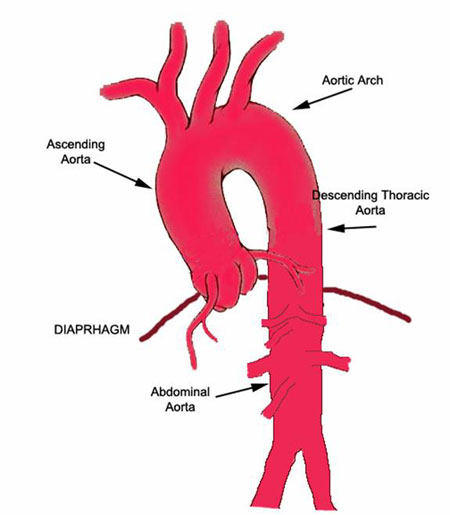 Diagram Of Ascending Aorta