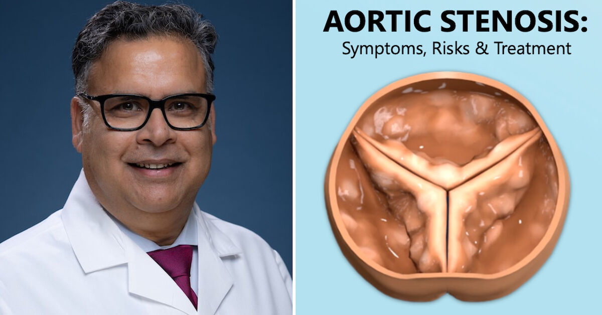 Cardiologist Q A Aortic Stenosis Symptoms Risks Treatment