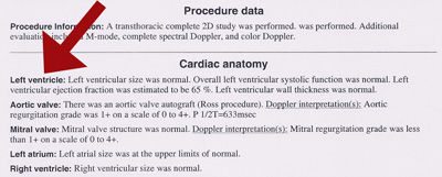 Echocardiogram findings