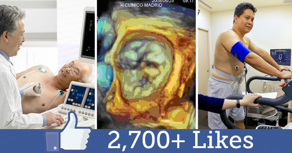 Echocardiogram for heart valve disease