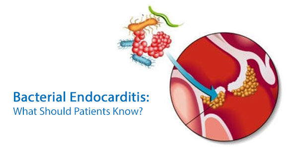 Bacterial Endocarditis