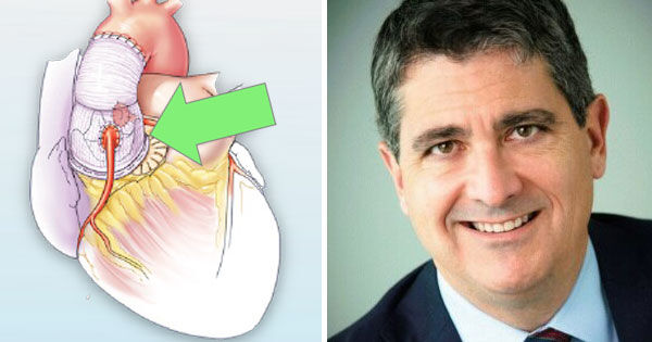 Cardiac Innovation: BeSPoKE Procedure for Patient Prosthesis Mismatch