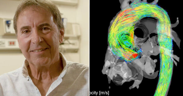 Heart valve patient next to 4D MRI of bicuspid aortic valve