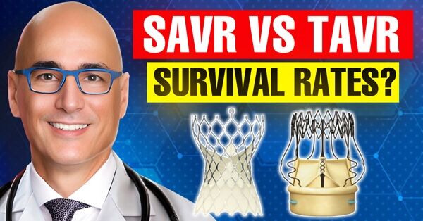 SAVR vs. TAVR Survival: Patients Over 65 Years Old