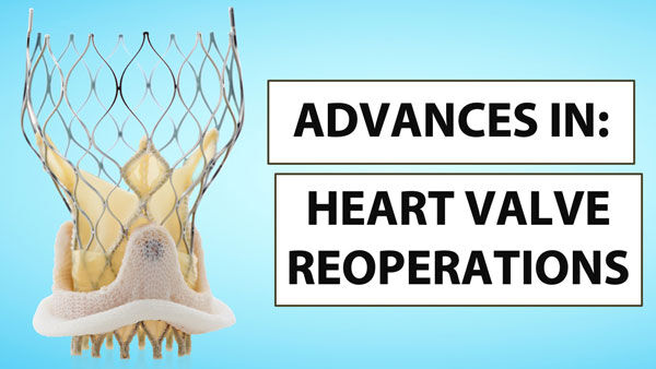 Heart Valve Voice Initiative Generates 250 Patient Comments to Medicare