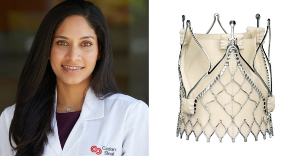 Ask The Expert: TAVR For Aortic Valve Regurgitation