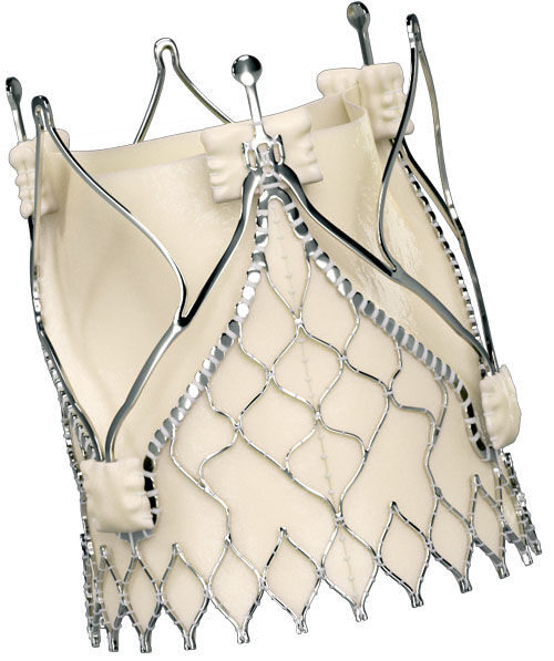 JenaValve (TAVR for Aortic Regurgitation)