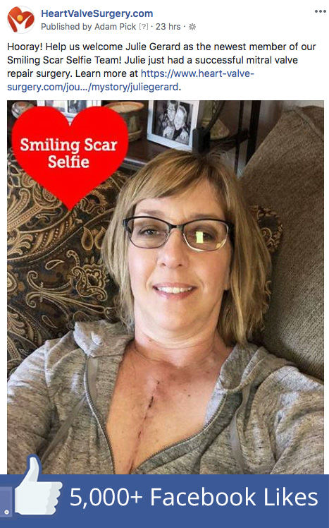Smiling scar selfie of Julie, heart surgery patient, on Facebook