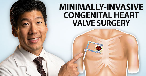 Surgeon Q&A: Minimally-Invasive Congenital Heart Valve Surgery