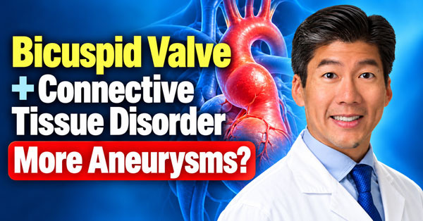 Surgeon Q&amp;A: Treating Aneurysms, Bicuspid Aortic Valves and Connective Tissue Disorders