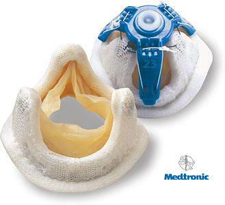 Mosaic Pig Valve Replacement By Medtronic