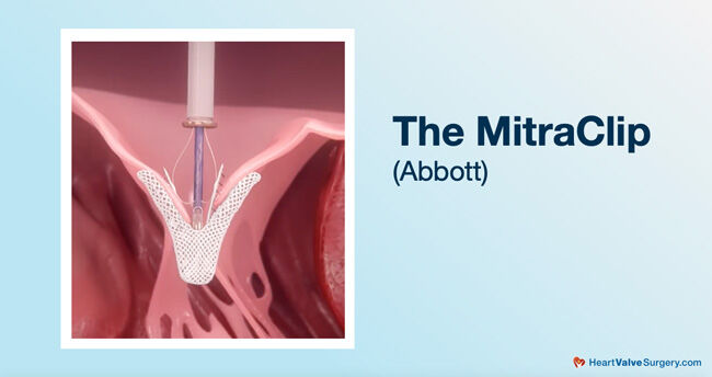 MitraClip Implanted in Mitral Valve