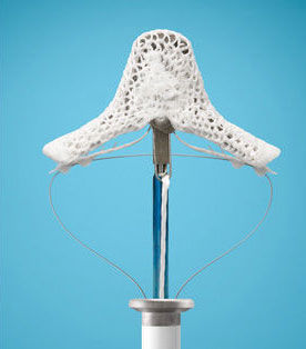 MitraClip by Abbott