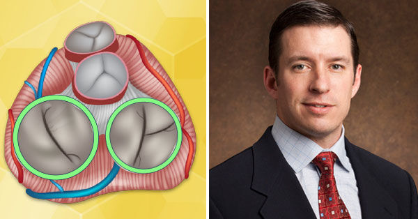 Dr. Robert Smith - Mitral and Tricuspid Valve