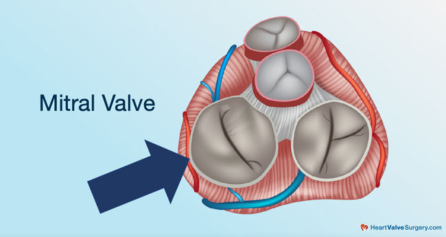 Mitral Valve Diagram