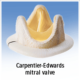 Porcine Valve Replacement Manufactured By Edwards Lifesciences