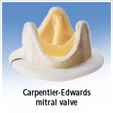 Pig Valve Transplant From Edwards Lifesciences