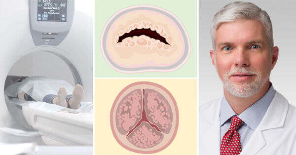 Radiation Therapy & Heart Valve Disease with Dr. Douglas Johnston