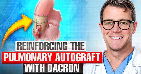 Ross Procedure Insights: Reinforcing the Pulmonary Autograft