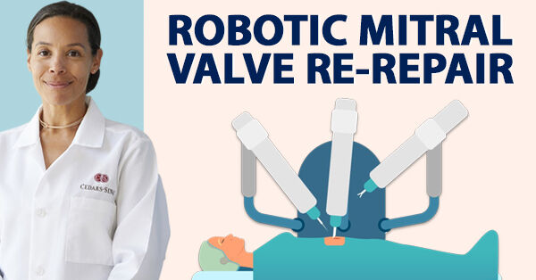robotic-mitral-re-repair