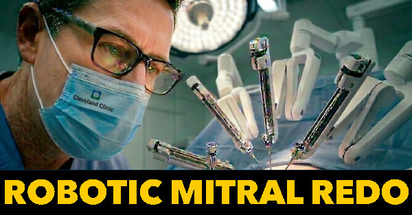 Surgeon Q&amp;A: Robotic Mitral Valve Re-Repair