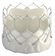 Transcatheter Aortic Valve Replacement