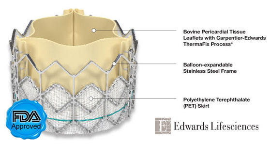 SAPIEN Heart Valve With Features & FDA Seal