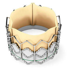 Top View Of SAPIEN TAVI Heart Valve