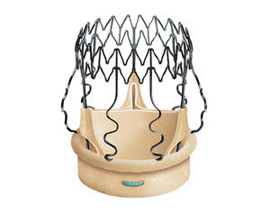 Perceval Aortic Heart Valve Replacement