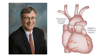 Dr. Paul Stelzer With Ross Procedure Diagram