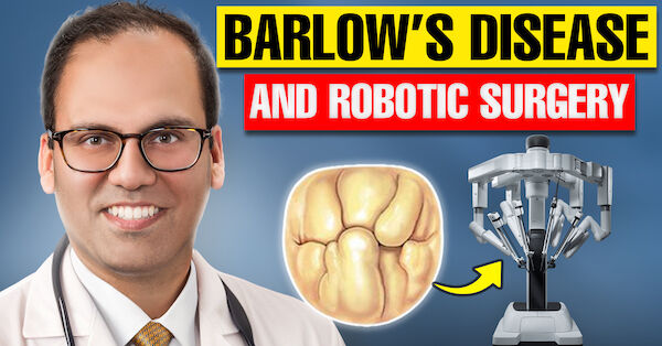 Can Minimally-Invasive Robotic Surgery Treat Barlow’s Mitral Valve Disease?