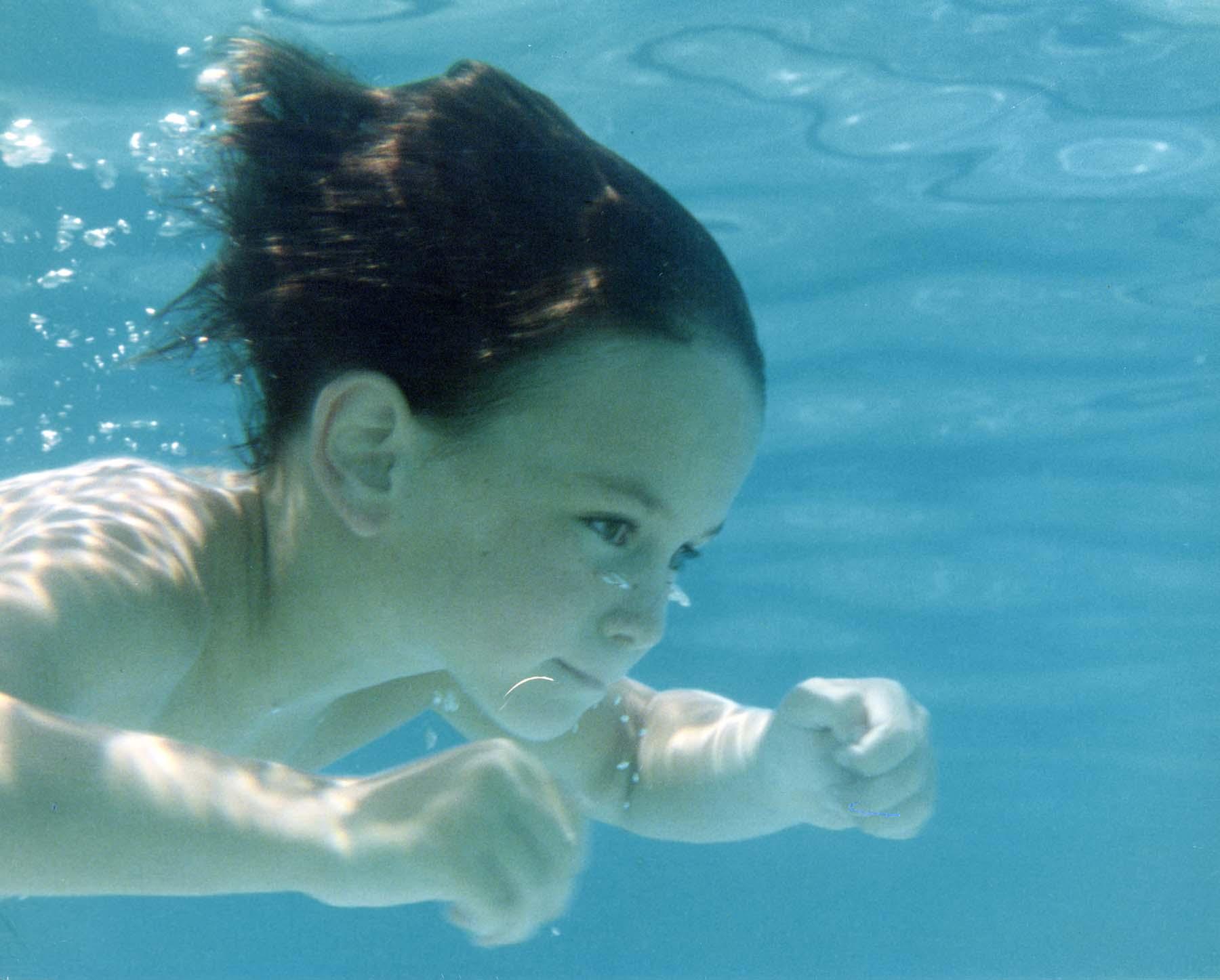 Adam Pick Swimming Before Heart Surgery At 2 Years Of Age