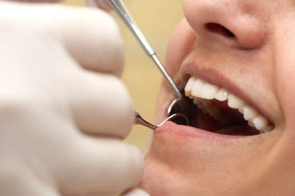 Teeth Cleaning Before Heart Valve Surgery