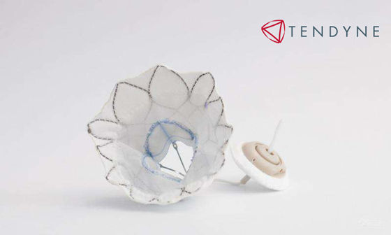 New Tendyne Transcatheter Mitral Valve Replacement Device