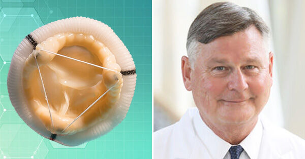Tissue Valve Replacement Durability for Young Patients