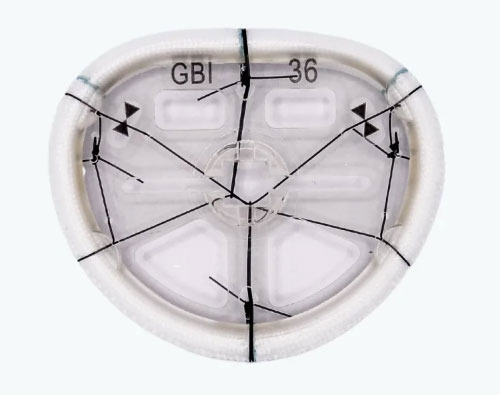 Transform McCarthy Mitral Valve Annuloplasty Repair Ring