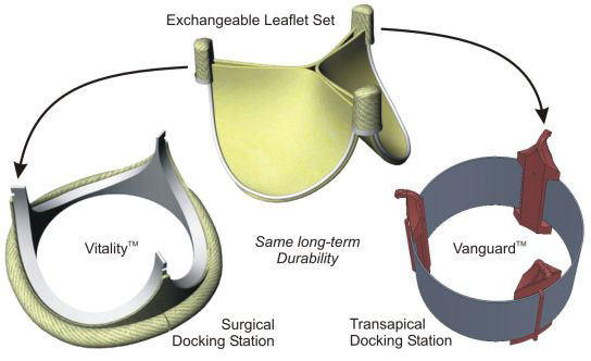 Diagram of ValveXchange Technology