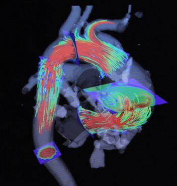 4D-MRI Picture of The Heart