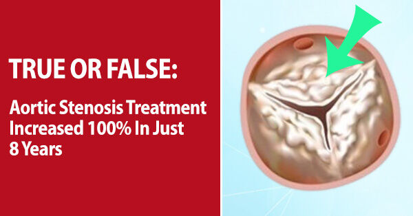 Aortic Stenosis Treatment: True or False