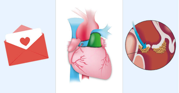 Ross Procedure & Endocarditis