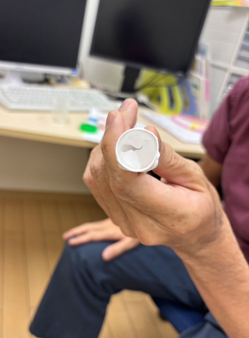 Ross Procedure PFTE Valve