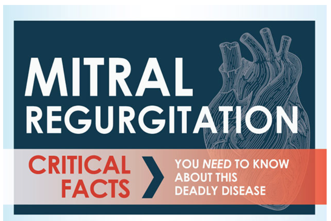 Mitral Regurgitation Infographic