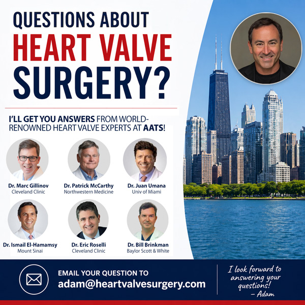 Ask Adam Pick Anything