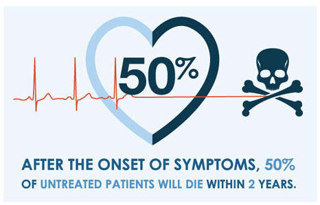 Aortic Stenosis Mortality Statistics