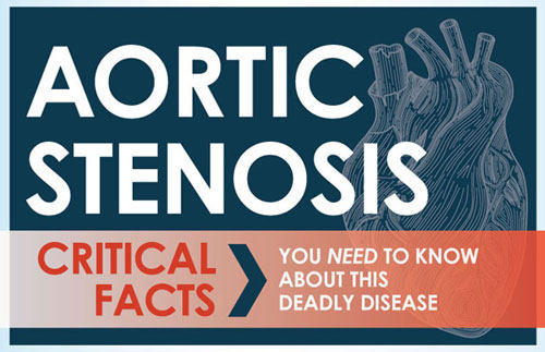 Aortic Valve Stenosis Infographic Facts