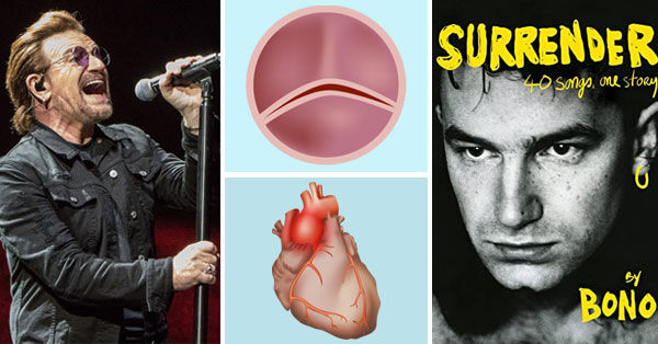 Bono Heart Valve & Aneurysm Surgery