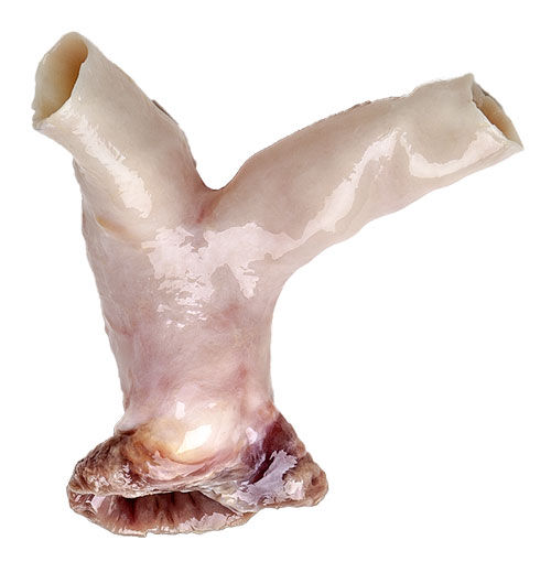 Cardiograft Pulmonary Valve by LifeNet Health