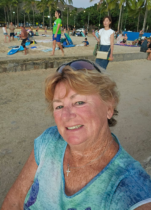 Dottie TAVR Patient In Hawaii