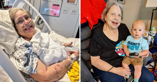 Hanah Earls - Dr. Per Wierup Heart Surgery Patient